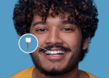 Implante dentário: quem pode fazer?