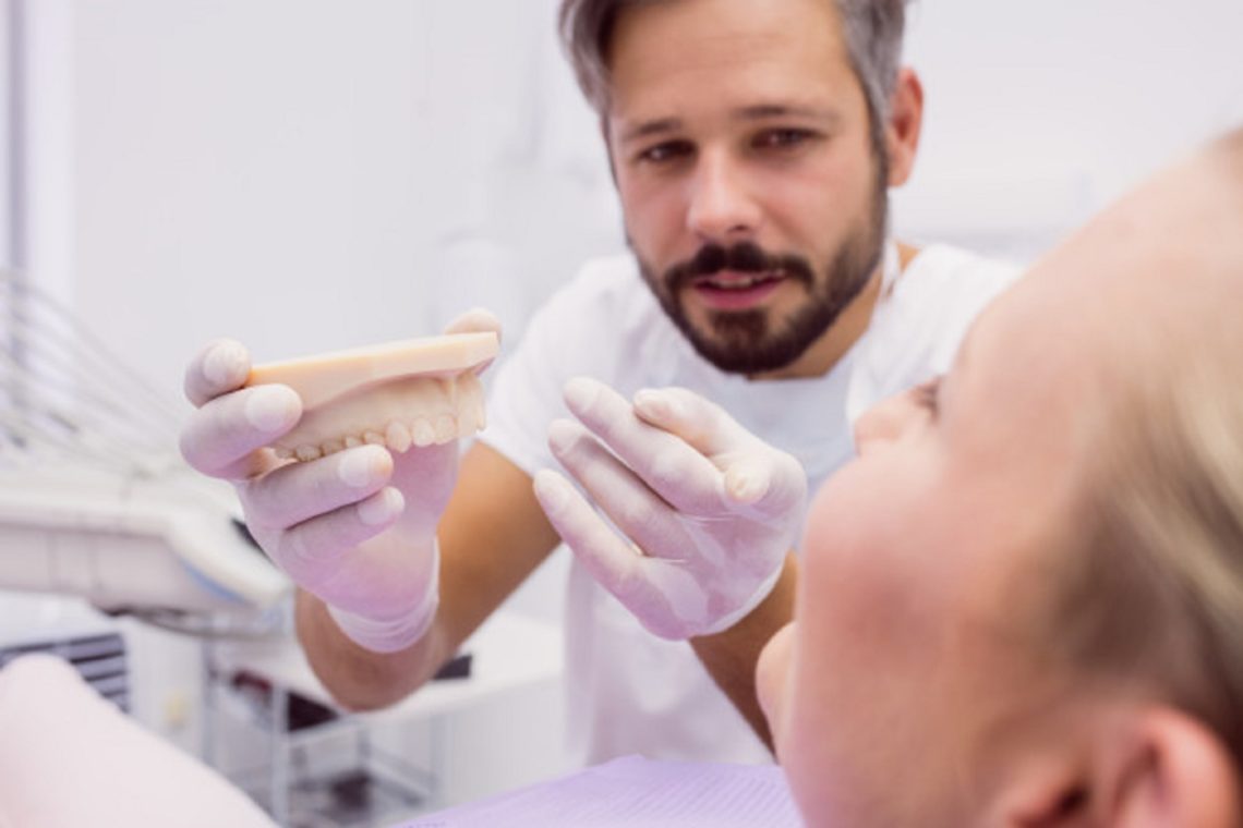 Implante dentário: 5 coisas que você precisa saber