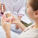 5 tipos de implantes dentários