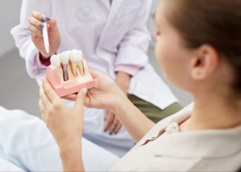 5 tipos de implantes dentários
