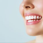 Lente de contato dental x facetas de porcelana: qual a diferença?