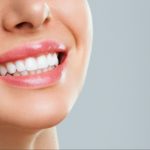 O que fazer se a minha lente de contato dental cair ou quebrar?