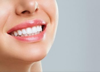 O que fazer se a minha lente de contato dental cair ou quebrar?