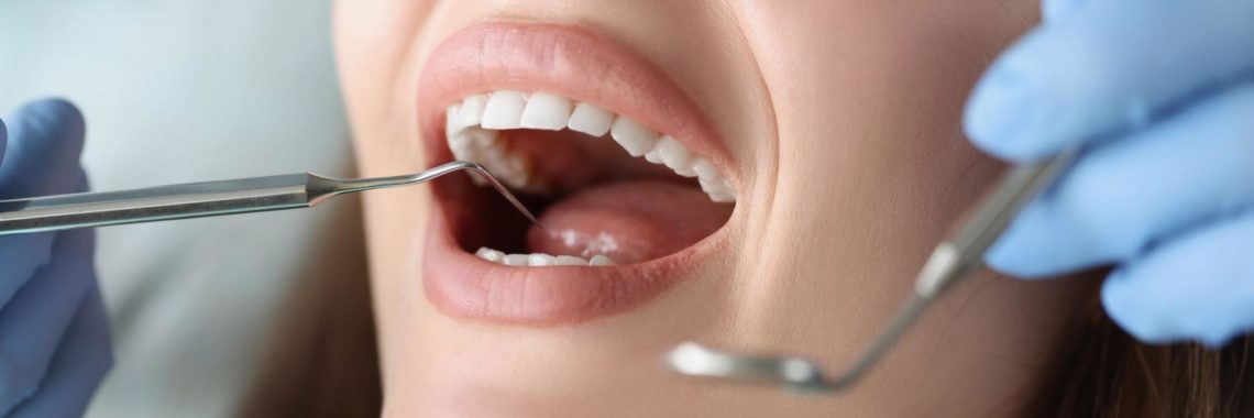 Como escolher o melhor especialista em lentes de contato dental?