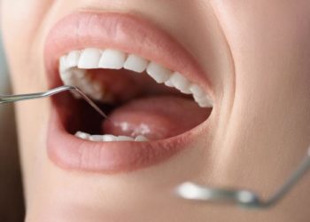 Como escolher o melhor especialista em lentes de contato dental?